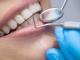 Professional Teeth Whitening in Preston | Achieve a Brighter Smile