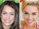 See Life-Changing Porcelain Veneers Before and After Results