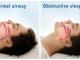 A Sleep Apnea Doctor’s Role in Restoring Balance and Better Health