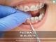 Affordable Dental Braces with Fastbraces® Technology in Allen, TX – All Smiles Dentistry