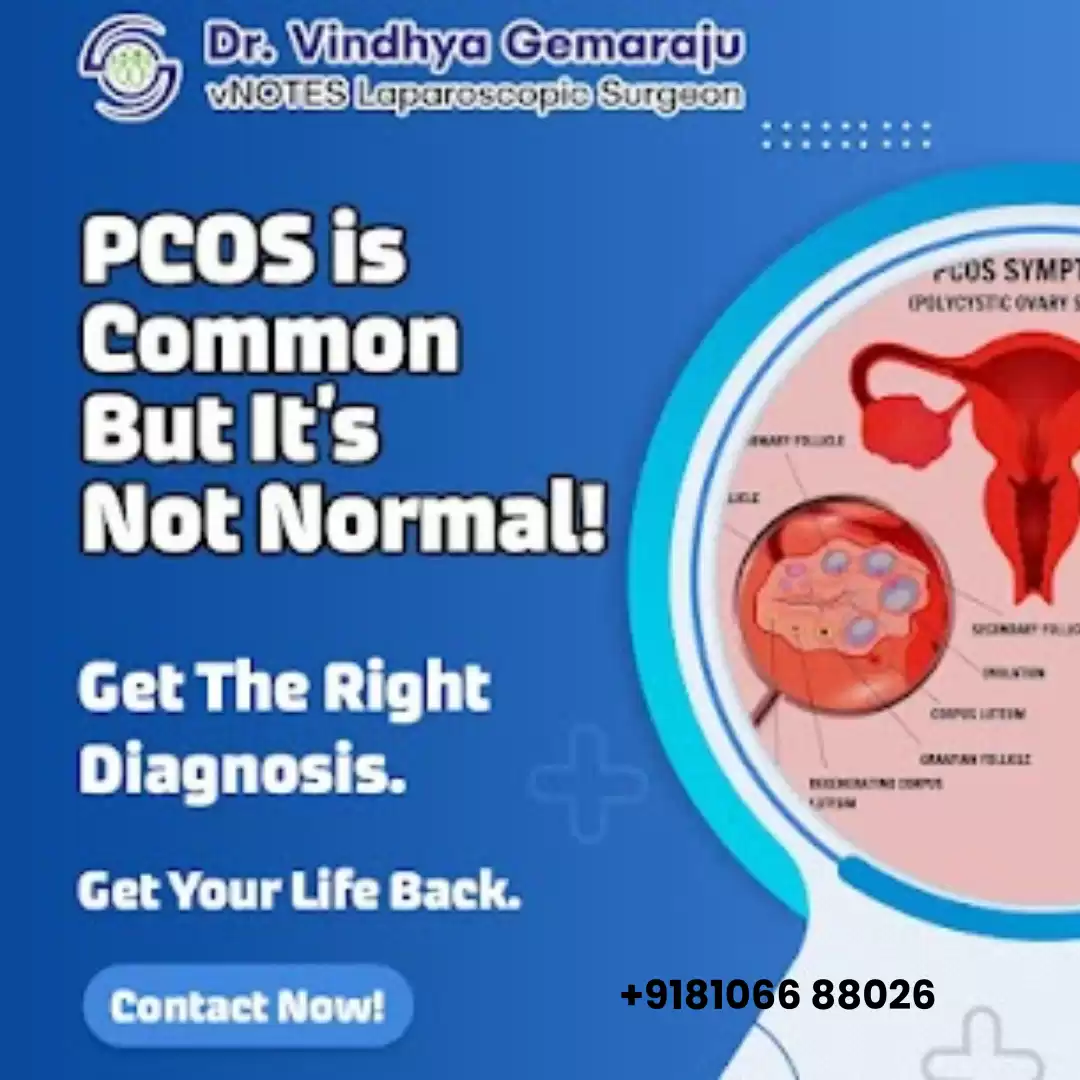 Best Gynaecologist for PCOS
