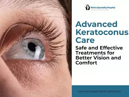 Effective Solutions by Best Doctors for Keratoconus Treatment in Indore