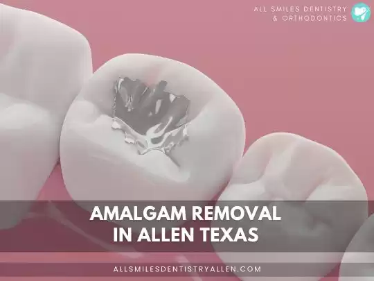 Safe Amalgam Removal Consultation – All Smiles Dentistry Allen
