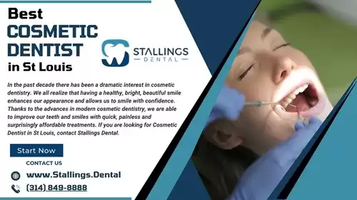 Discover the Best Cosmetic Dentist in St Louis Transforming Smiles with Advanced Dental Aesthetics
