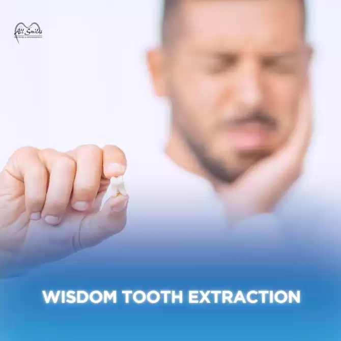 Wisdom Tooth Extraction in Allen, TX – Safe, Gentle & Same-Day Care