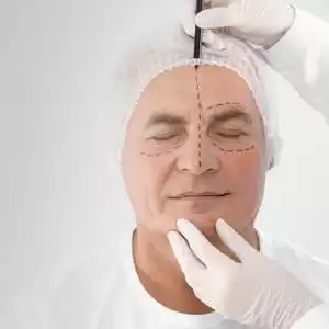 Rinoplastica Naso Prezzo