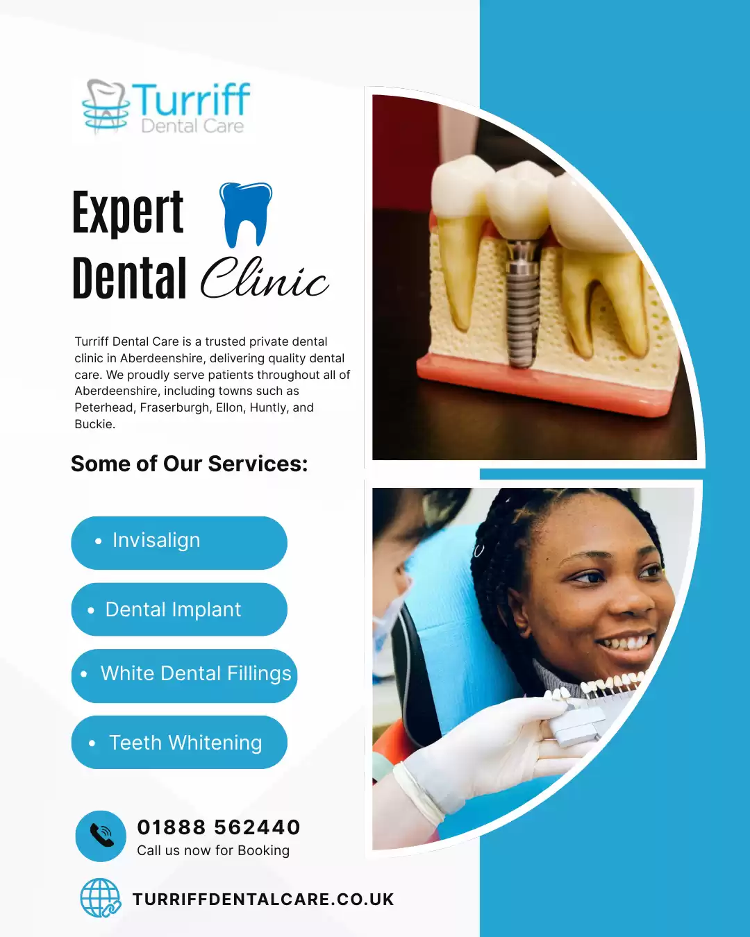 Dental Implants Aberdeenshire – Secure, Long-Lasting Tooth Replacement