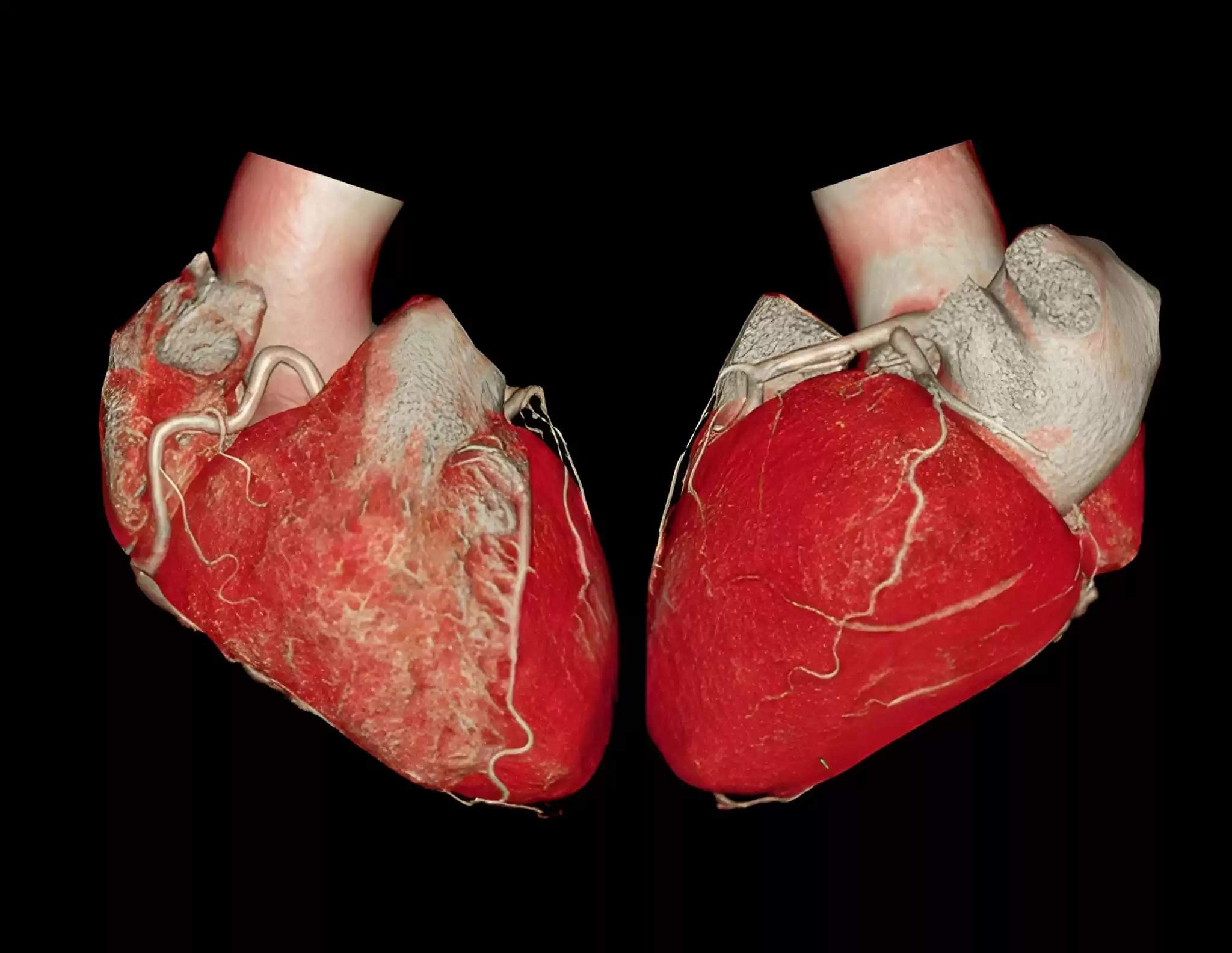 Best CT Scan Centre in Navi Mumbai | HRCT, Brain, Chest, Abdomen, Pelvis, 3D CT | Juinagar, Nerul, Seawoods, CBD Belapur, Kharghar, Panvel – Henotic Diagnostics