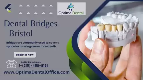 Dental Bridges Bristol Reliable Tooth Replacement Solutions at Optima Dental Office