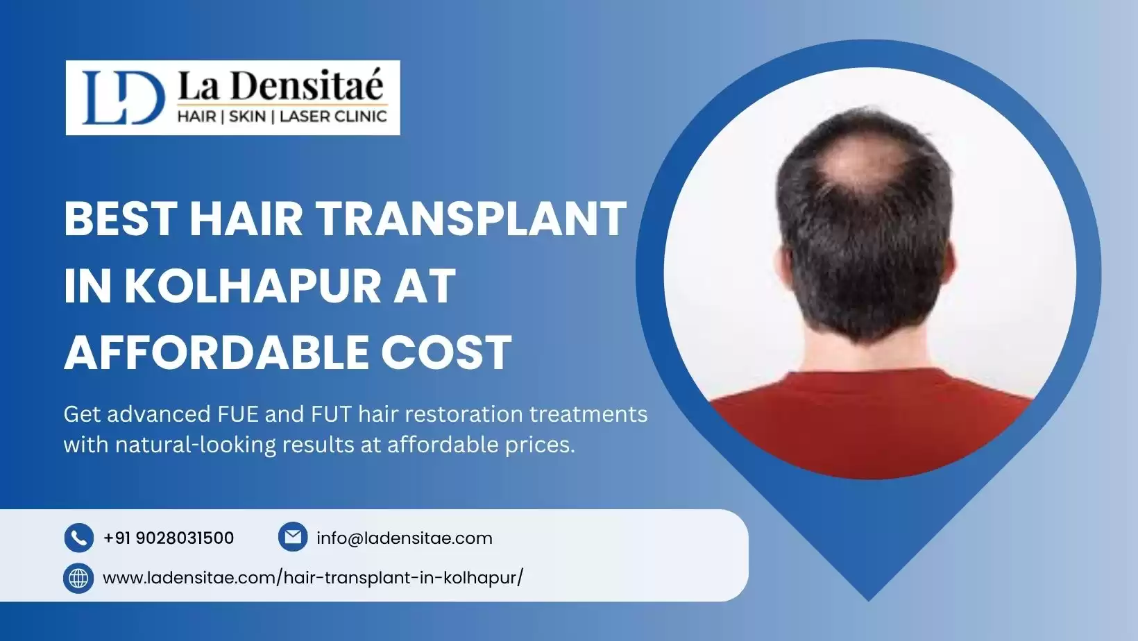 Best Hair Transplant in Kolhapur at Affordable Cost