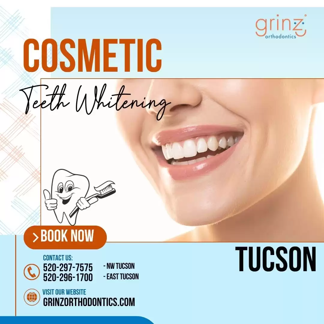 Cosmetic Teeth Whitening in Tucson