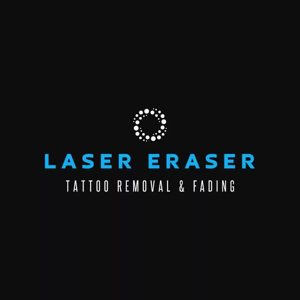 Advanced Laser Light Tattoo Removal For Clearer Skin