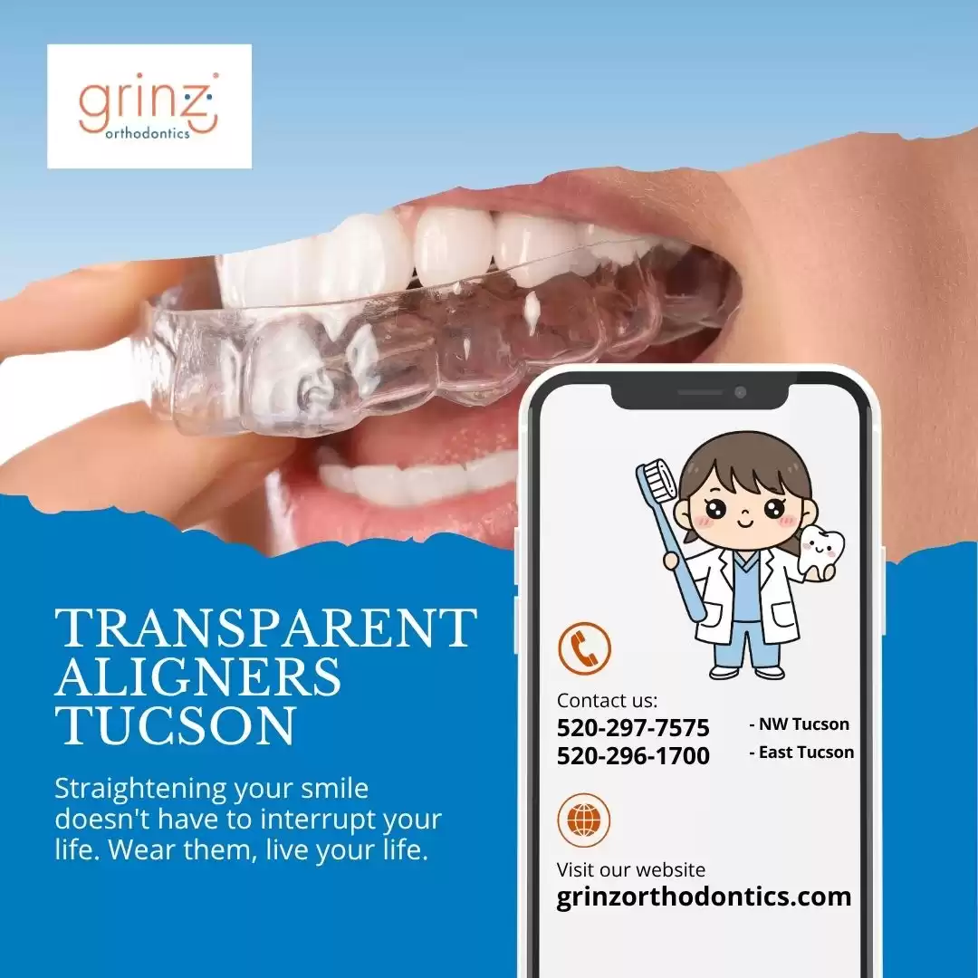 Transparent Aligners in Tucson