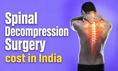 Affordable Spinal Decompression Surgery Cost in India for International Patients | HOSPIDIO