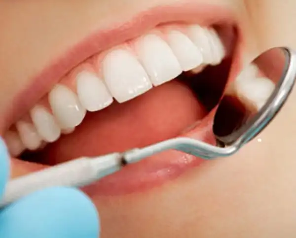 Affordable Wisdom Teeth Infection Removal Treatment