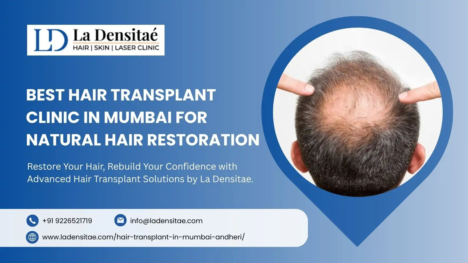 Best Hair Transplant Clinic in Mumbai for Natural Hair Restoration