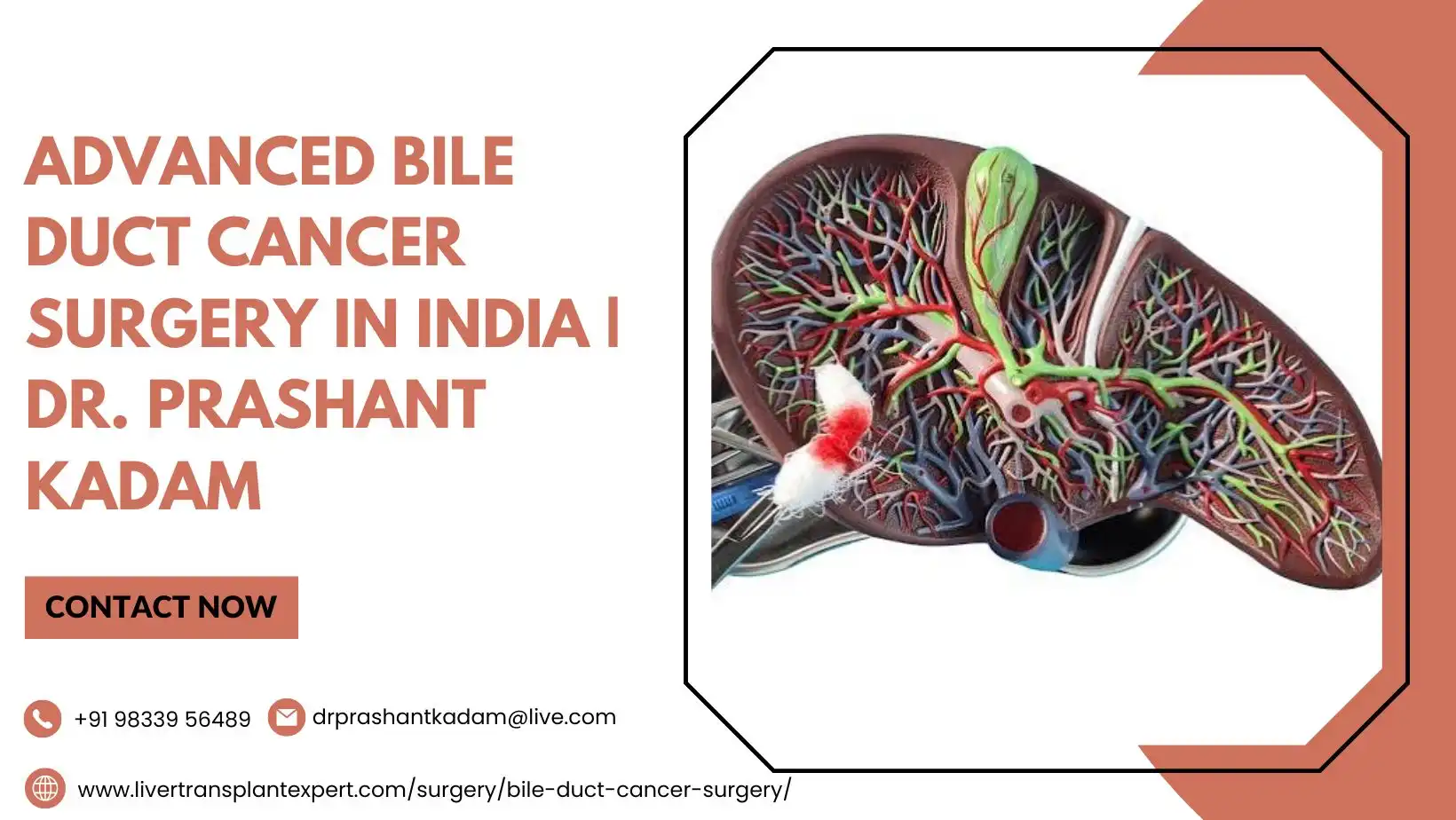 Advanced Bile Duct Cancer Surgery in India | Dr. Prashant Kadam