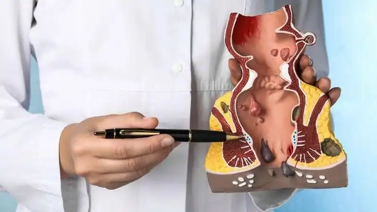 Advanced Care for Pilonidal Sinus & Piles 