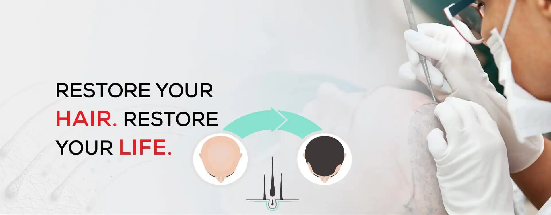 Hair Loss Treatment Vadodara for Effective Hair Restoration and Personalised Care Solutions | Clion Care