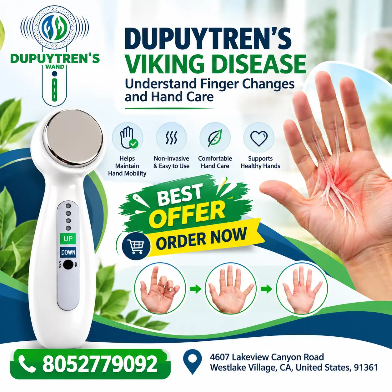 Dupuytren's Viking Disease: Understand Finger Changes and Hand Care