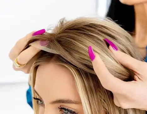 Expert Hair Loss Solutions Dallas